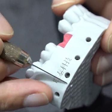 口腔3d打印机的应用改变了我们对牙科的看法