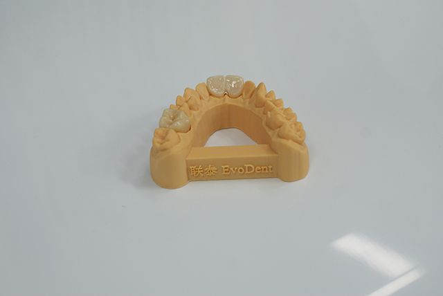 3D打印在口腔齿科领域都这么卷了吗?