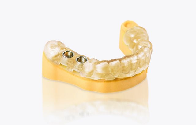 联泰答疑室 | 3D打印,我劝你在医疗行业别这么“嚣张”