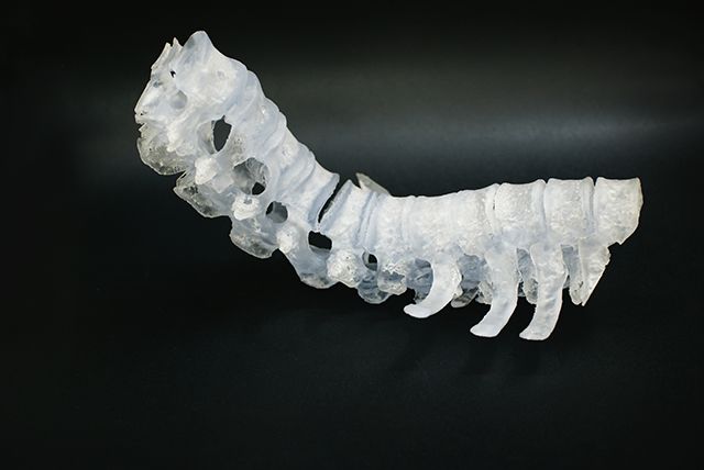 联泰答疑室 | 3D打印,我劝你在医疗行业别这么“嚣张”