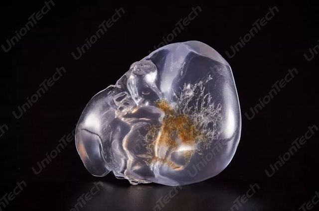 联泰答疑室 | 3D打印,我劝你在医疗行业别这么“嚣张”