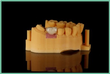 “以科技破局,以数字化赋能”——ng28南宫与精瓷义齿共创齿科3D打印医疗新未来06 “以科技破局,以数字化赋能”——ng28南宫与精瓷义齿共创齿科3D打印医疗新未来06