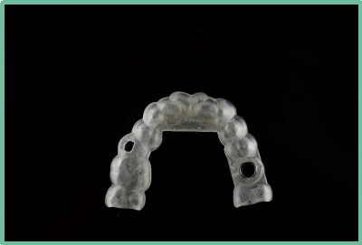 “以科技破局,以数字化赋能”——ng28南宫与精瓷义齿共创齿科3D打印医疗新未来01 “以科技破局,以数字化赋能”——ng28南宫与精瓷义齿共创齿科3D打印医疗新未来01