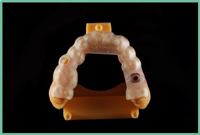 “以科技破局,以数字化赋能”——ng28南宫与精瓷义齿共创齿科3D打印医疗新未来02 “以科技破局,以数字化赋能”——ng28南宫与精瓷义齿共创齿科3D打印医疗新未来02