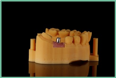 “以科技破局,以数字化赋能”——ng28南宫与精瓷义齿共创齿科3D打印医疗新未来03 “以科技破局,以数字化赋能”——ng28南宫与精瓷义齿共创齿科3D打印医疗新未来03