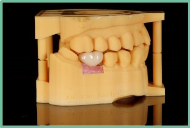 “以科技破局,以数字化赋能”——ng28南宫与精瓷义齿共创齿科3D打印医疗新未来05 “以科技破局,以数字化赋能”——ng28南宫与精瓷义齿共创齿科3D打印医疗新未来05