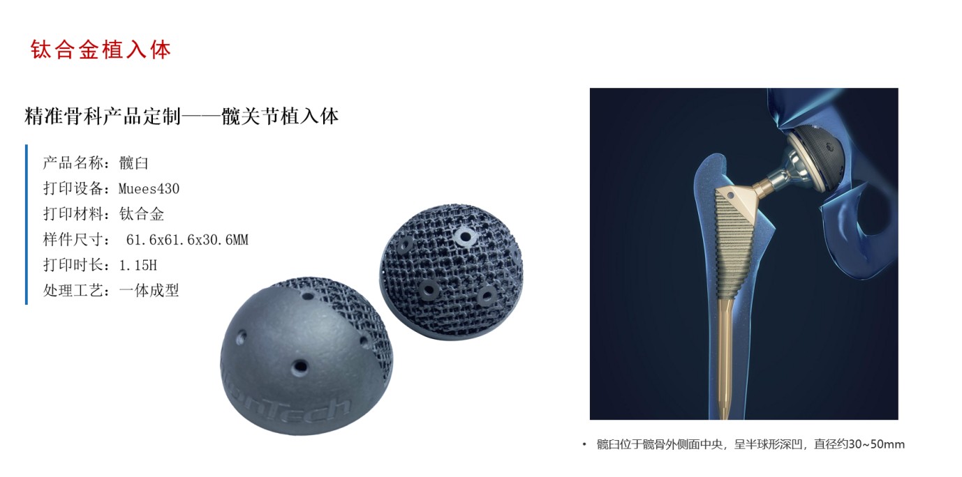 医疗3D打印技术